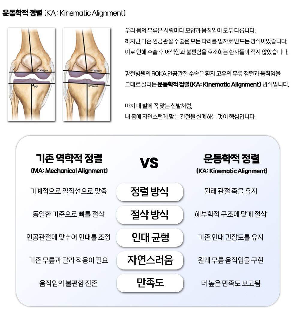 운동학적 정렬 (KA)  설명