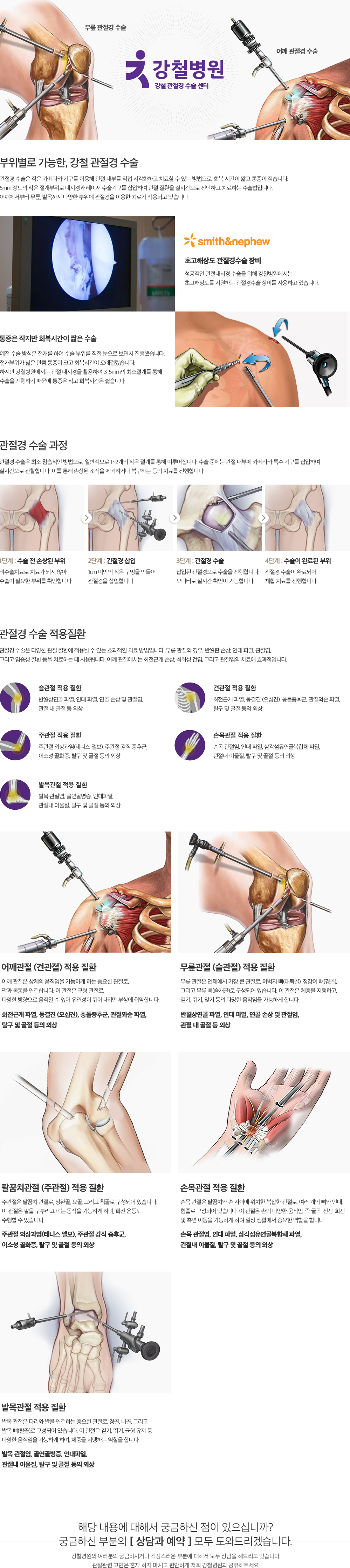 관절경 수술