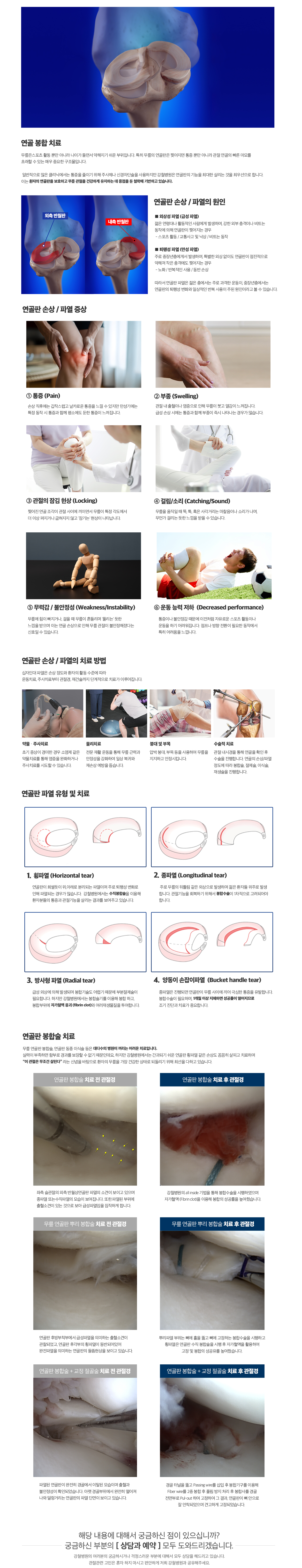연골봉합술