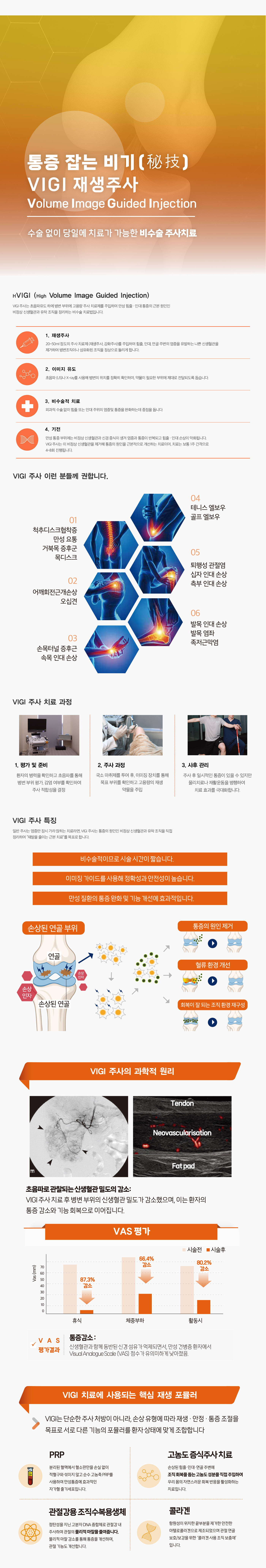 비수술치료