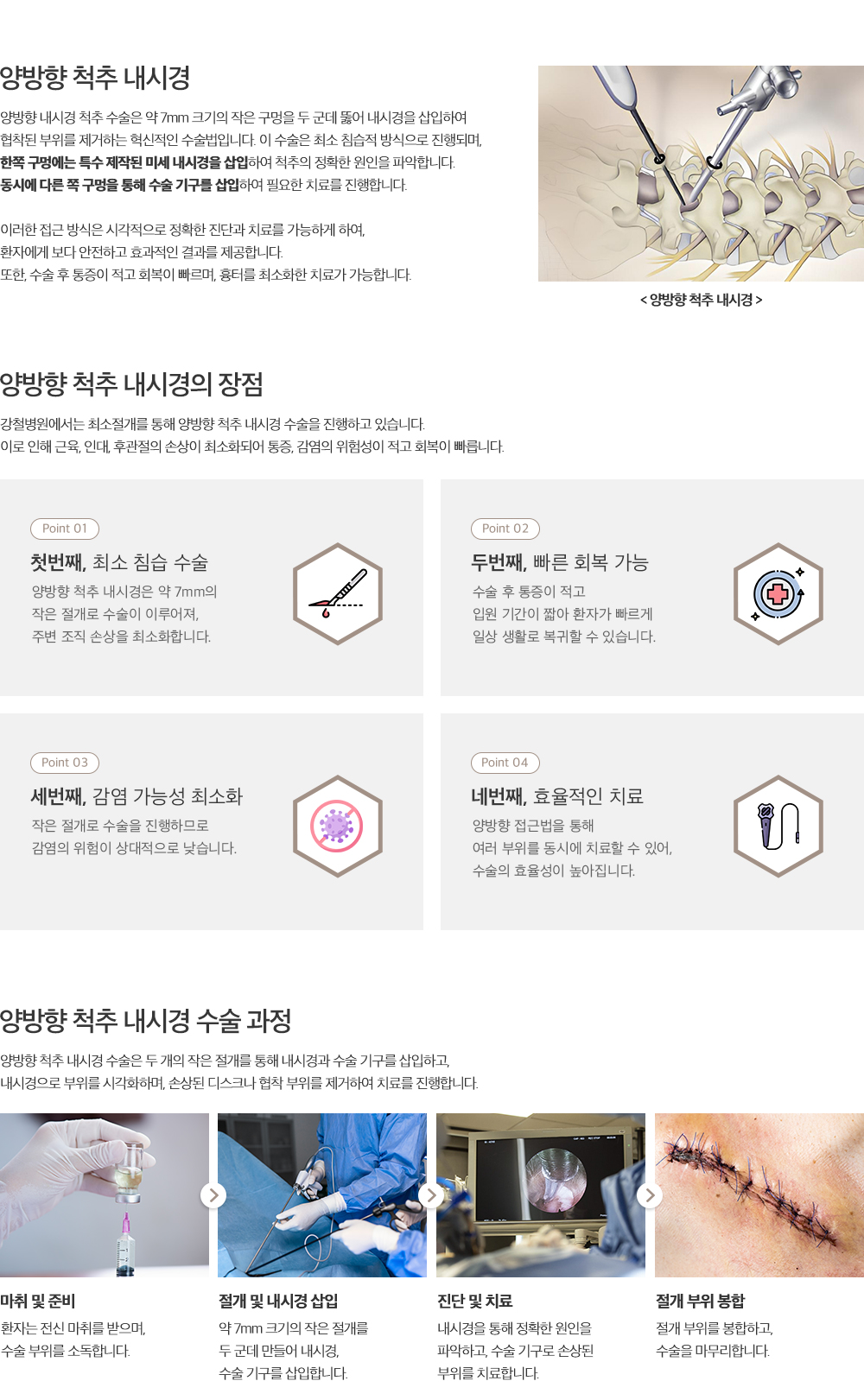 양방향 척추 내시경 설명